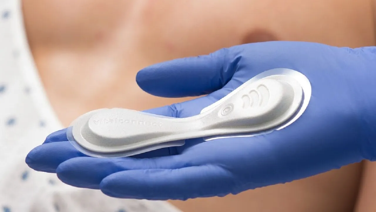 A MediBioSense VitalPatch biosensor held in an open hand